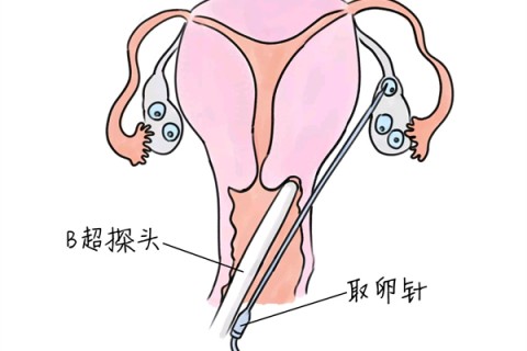 http://xuzhou.vdtfzz.com/post/205.html|徐州供卵助孕
