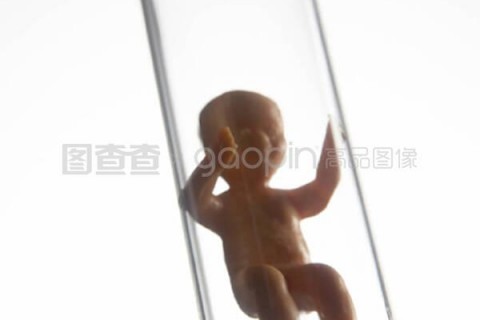 http://xuzhou.vdtfzz.com/post/197.html|徐州试管助孕